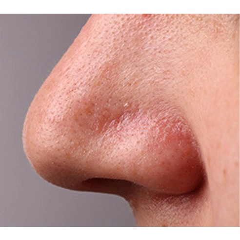 Blackhead PHA Cleansing Oil, 200ml - Image 5