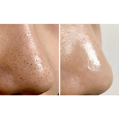 P.Z. Ssoc Ssoc No More Blackhead Nose Pack, 1ea - Image 9