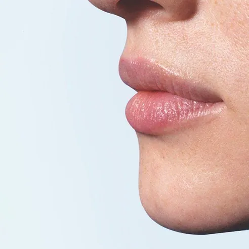 Cicaplast Levres Lip Balm, 1pack - Image 4