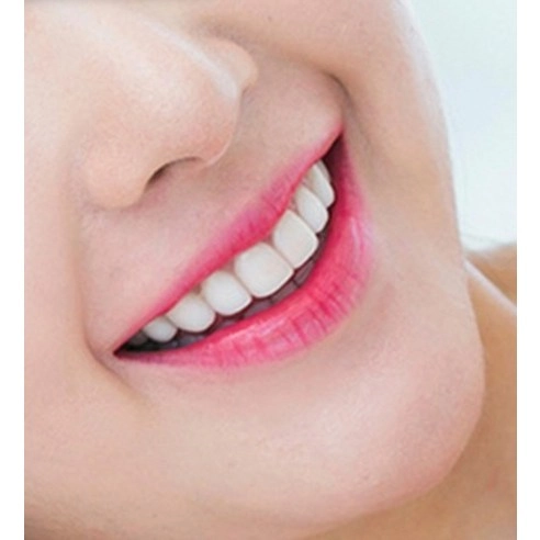 Claren White Now - Image 5