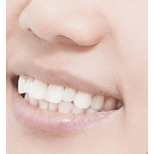 Claren White Now - Image 6