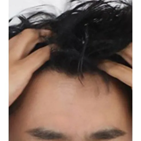 No-wash Shampoo, 100ml, 1pack - Image 5