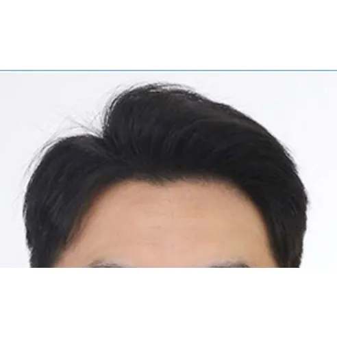 No-wash Shampoo, 100ml, 1pack - Image 8