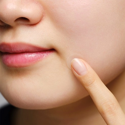 Acne Doctor 1st Speedy Microshot Patch, 9ea, 1pack - Image 7