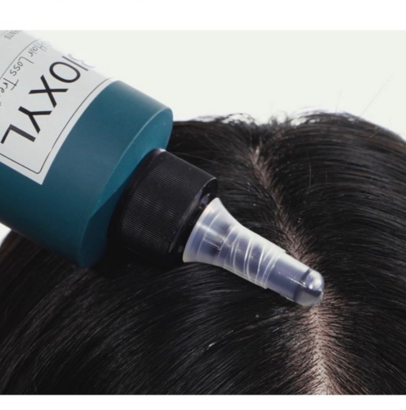 Bioxcyl Anti Hair Loss Treatment - Image 2