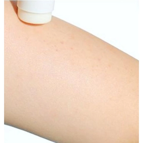 Ibodle CCP Stick Balm, 10g, 1pack - Image 10