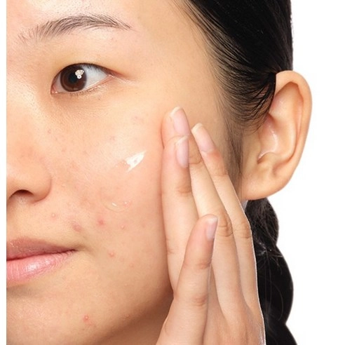 Aloe 2% + NAG 2% Solution - Image 4