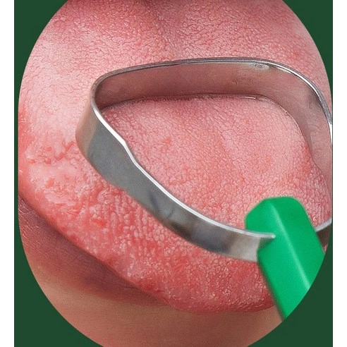 Classic Tongue Cleaner - Image 7