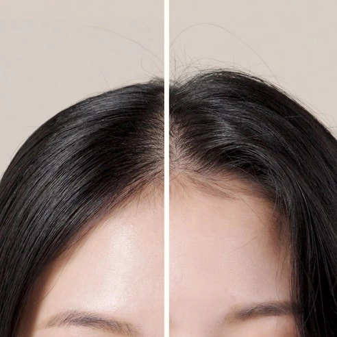 Root:Gen Hair Loss Care Hair Volume Filler, 150ml, 1pack - Image 3