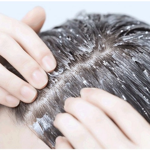 Scalp Strengthening Clinic Capsule Treatment, 220ml, 1pack - Image 6