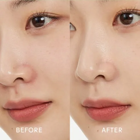 Banana Spot Calming Cream, 15g, Green, 1pack - Image 4