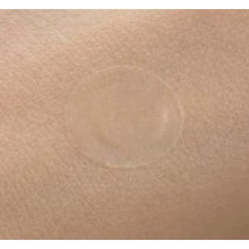 Garlic AC Reedle Shot Spot Patch, 48ea, 1pack - Image 2