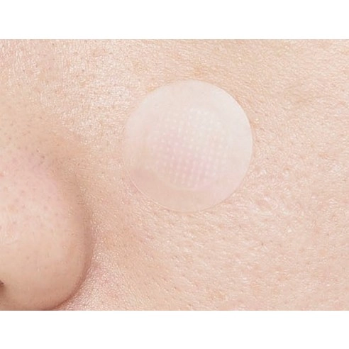 Garlic AC Reedle Shot Point Patch, 9ea, 1pack - Image 3