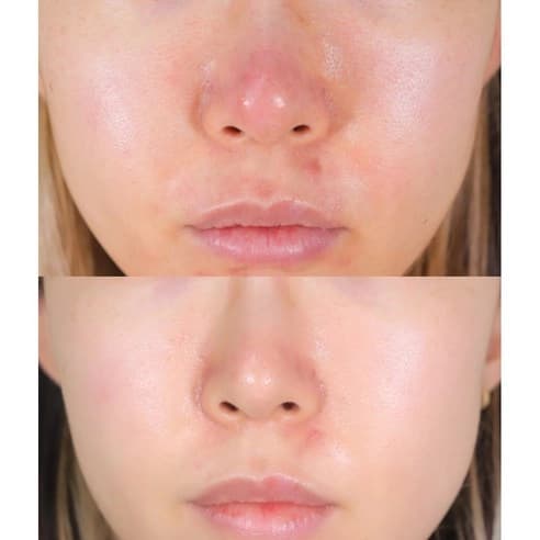 Intensive Whitening Vita Moisture Cream, 50ml - Image 7